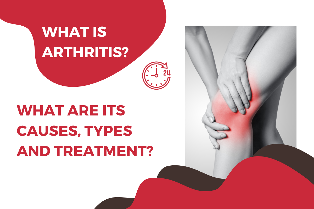 What is Arthritis